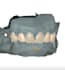 create a digital smile design dsd and dental mockup
