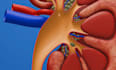 animate your surgical procedure , medical device in 3d