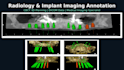 do radiology image and medical imaging  annotation