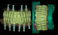 create precise dental cad model on exocad for crowns bridges veneers implants