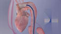 create scientifically accurate 3d medical animation