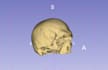 do 3d medical image segmentation from ct using 3d slicer