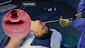 create 3d surgical and medical procedure animation