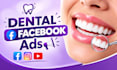 manage dental facebook ads for implant lead generation