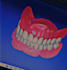 provide expert exocad dental cad design services