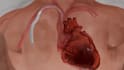 create 3d cardiovascular medical device animation and medical explainer video