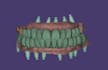 all on x full arch implant prostheses using exocad