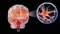 create 3d medical surgery animation brain anatomy neurological disease explainer