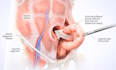 create 3d ai medical animation, ai surgery animation, ai explainer pharma video