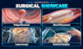 create surgical animation and medical procedure videos