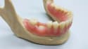 create 3d dental implant animation and medical explainer video
