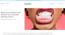 write professional seo dental articles and dental blogs