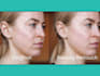 skin retouch in video, beauty retouch, color correct, blemish removal, cleanup