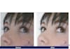 photo retouch 3 Photos