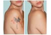 remove tattoos from your images