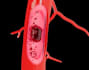 do surgery 3d animation