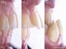 refine cosmetic or dental photos to make great posts