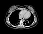 a second opinion on any radiology scan mri, xray, ct, US