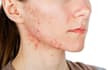 write an engaging skincare and lifestyle article for your brand