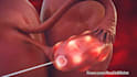 do high quality 3d medical animation and illustration
