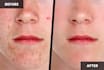 retouch photo edit image