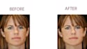 image restore, enhance, fix picture, resizing and bg remove