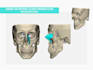 do  3d maxillofacial reconstruction and craneal prosthesis
