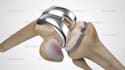 create medical 3d animation video