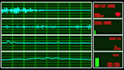 create a heart monitor music or audio visualizer horizontal or vertical