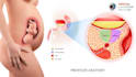 create professional high quality 3d 2d medical animation video