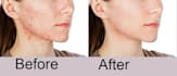 do photoshop retouch professionally