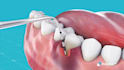 make 3d medical animation