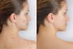 do professionally photo retouching, skin retouch