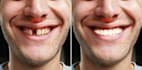fix teeth, whiten teeth, remove braces