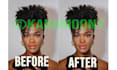 realistic nose job rhinoplasty photo simulation surgery