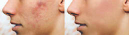 do skin retouching and keep it natural