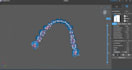 design dental crowns,bridges,veneers in 3shape