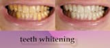 make you a skin retouch