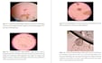technical reports on parasitology