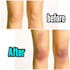 photoshop edit wounds ,bruises and blood from your photo