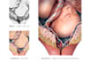 create surgical and anatomical art for medical professionals