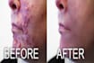 retouch your photo