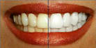 turn your smile into a perfect white smile