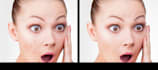 remove your 15 image pimples and brightens it within 1 day