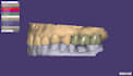 design your dental restorations