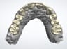 do waxup mockup and monolithic zirconia design using 3shape
