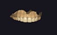 dental design with exocad