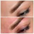 do retouching after cosmetic procedures