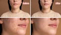 do natural beauty face skin photo retouching