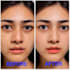 retouch your image with high quality and remove blemish
